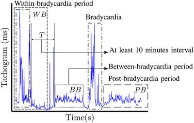 Maturation of the Autonomic Nervous System in Premature Infants: Estimating Development Based on Heart-Rate Variability Analysis